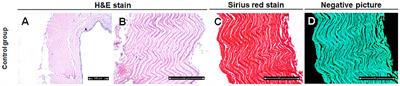 Validation of Three Different Sterilization Methods of Tilapia Skin Dressing: Impact on Microbiological Enumeration and Collagen Content